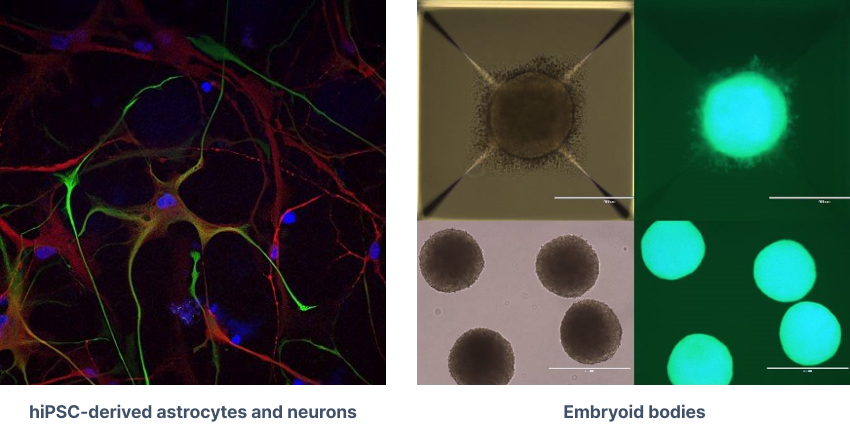 Development of an astrocytic scar model in brain using patient-derived glioblastomaorganoids