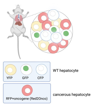 Spatial metabolomic and lipidomic analysis of liver diseases using MALDI mass spectrometry imaging